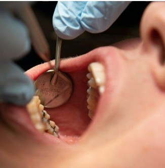 Restorative Treatment